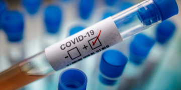 Salud Pública reporta 20 personas hospitalizadas por COVID-19 en el país