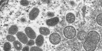 Síntomas y cómo se transmite la viruela del mono