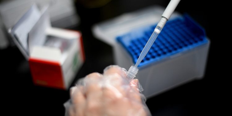 EE.UU. confirma su primer caso de viruela de los monos este año